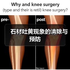 石材吐黄现象的清除与预防(图2) 石材吐黄现象的清除与预防(图2)